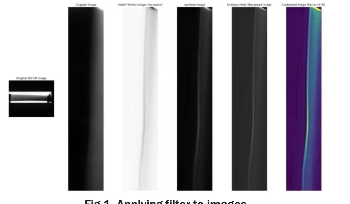 A row of the same vane X-ray at each processing stage: original DICOM, cropped, Sobel filtered, inverted, unsharp-mask sharpened, and contrast enhanced