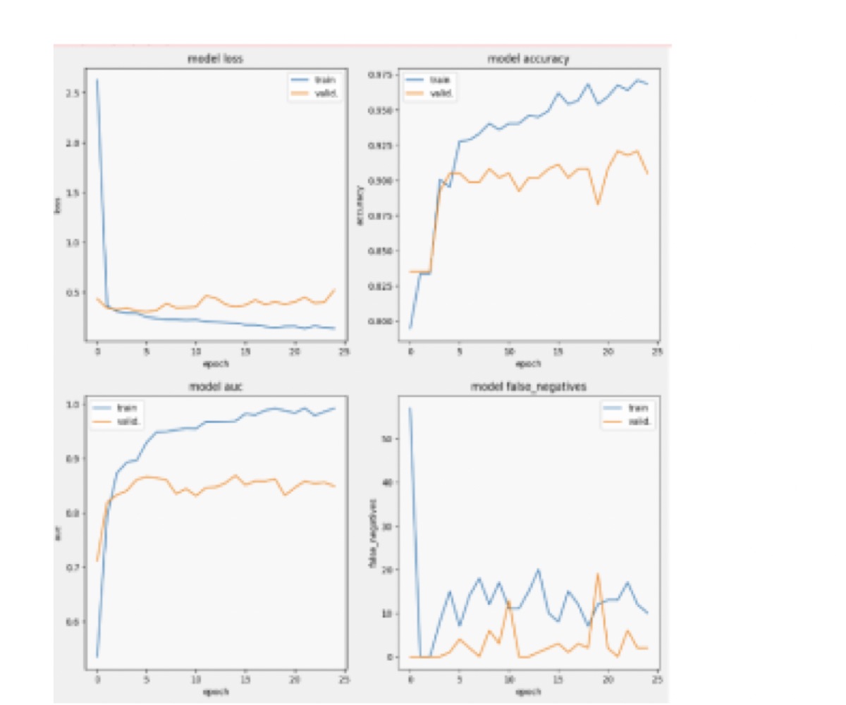 Four plots over 25 epochs (loss, accuracy, AUC, and false negatives) each showing training and validation curves diverging.